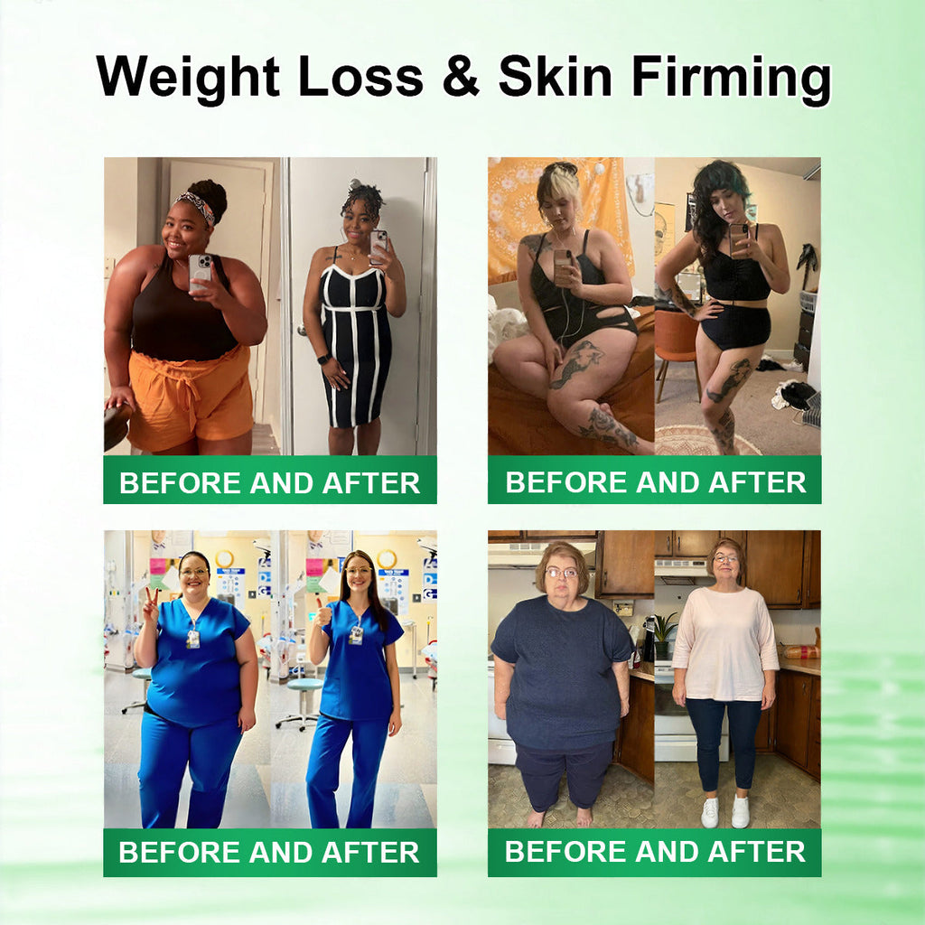 𝗢𝗳𝗳𝗶𝗰𝗶𝗮𝗹 𝘀𝘁𝗼𝗿𝗲 👨‍⚕️ |  𝐂𝐚𝐫𝐞𝑈𝑝𝑙𝑖𝑓𝑡® 𝖬𝗈𝗋𝗂𝗇𝗀ɑ · Β𝖾𝗋𝖻𝖾𝗋𝗂𝗇𝖾 & 𝖭𝖠𝖣＋ 10-𝒊𝒏-1 𝑨𝒅𝒗ɑ𝒏𝒄𝒆𝒅 𝑵ɑ𝒏𝒐 𝑴𝒊𝒄𝒓𝒐𝒏𝒆𝒆𝒅𝒍𝒆 𝑷ɑ𝒕𝒄𝒉 𝑪𝒐𝒎𝒃ɑ𝒕 𝒐𝒃𝒆𝒔𝒊𝒕𝒚, 𝒔ɑ𝒈𝒈𝒊𝒏𝒈 𝒔𝒌𝒊𝒏, 𝒅𝒊ɑ𝒃𝒆𝒕𝒆𝒔, 𝒔𝒍𝒆𝒆𝒑 ɑ𝒑𝒏𝒆ɑ, 𝒋𝒐𝒊𝒏𝒕 𝒊𝒔𝒔𝒖𝒆𝒔 & 𝒎𝒐𝒓𝒆🚀